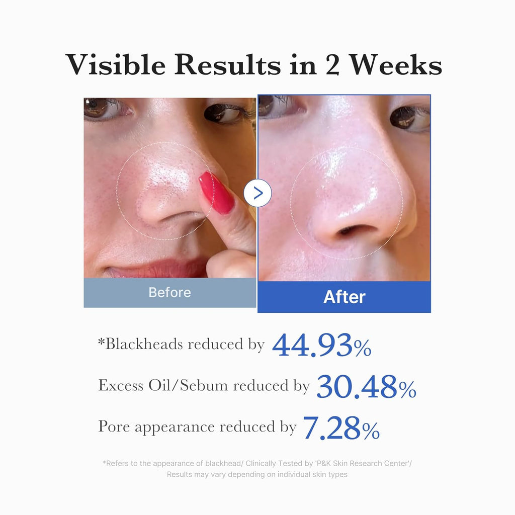 Medicube Zero Pore Pad 2.0