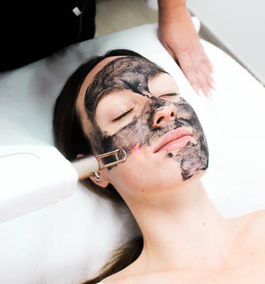 Hollywood Laser Carbon Peel