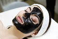 Hollywood Laser Carbon Peel